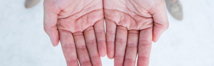 Nawracająca suchość dłoni podczas zimy - jaką pielęgnację skóry wdrożyć?